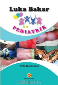 Image of Luka Bakar Pediatrik