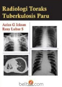 Image of Radiologi Toraks Tuberkulosis Paru